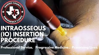 Intraosseous IO Insertion Procedure [upl. by Kittie604]