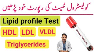 How To Read Cholesterol Test Report Urdu Hindi  Lipid Profile Test  HDL LDL amp Triglycerides Test [upl. by Cynera]