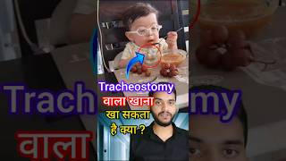 Tracheostomy patient feeding shorts [upl. by Ohcamac986]