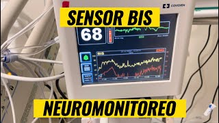 Sensor BIS monitorizacion neurologica [upl. by Donell]