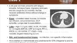 Detecting Vasculitis Before Its Too Late [upl. by Certie40]