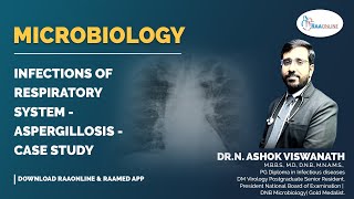 Microbiology  Aspergillosis  Case study  Raaonline [upl. by Ark758]