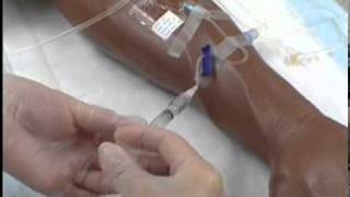 Intravenous IV Therapy Administering IV Medication via a Saline Lock [upl. by Drofxer364]