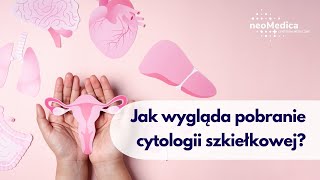 Jak wygląda pobranie cytologii szkiełkowej [upl. by Merrie]