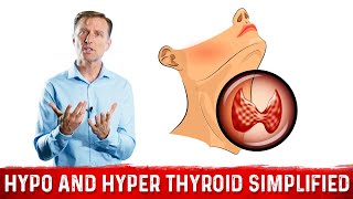 Hyperthyroid vs Hypothyroid Explained By Dr Berg [upl. by Jesus269]