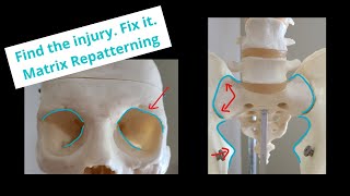 Matrix Repatterning Treatment Guide [upl. by Columbine]