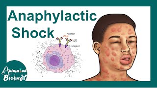 Anaphylactic shock  Anaphylactic Reaction Symptoms and Treatment [upl. by Zug]