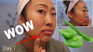 I USED FRESH ALOE VERA FOR 7 DAYS AND LOOK WHAT HAPPENED [upl. by Agbogla]