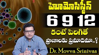 Dr Movva Srinivas  What Causes of Chest Pain  Heart Attack  Checkup Homocysteine Test [upl. by Cosme]