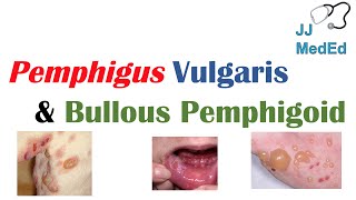 Vesiculobullous Skin Diseases  Pemphigus Vulgaris vs Bullous Pemphigoid [upl. by Ylyl]