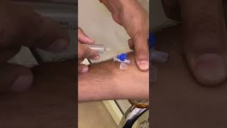 IV cannula insertiondoctertrendingforyoushortsviralvideoshortvideo [upl. by Ahsikat606]