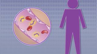 Detecting Nasopharyngeal Carcinoma in Asymptomatic Persons [upl. by Inaliel]