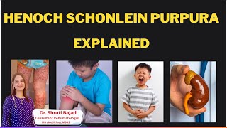 HenochSchonlein Purpura  IGA Vasculitis  Dr Shruti Bajad vasculitis arthritis [upl. by Olegnaleahcim207]