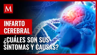 ¿Hay síntomas ¿Qué es un infarto cerebral y cuáles son sus posibles causas [upl. by Netty]