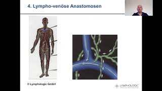 Video 1  Selbstmanagement in der Lymphologie  Grundlagen [upl. by Wirth]