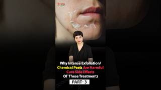 How to Heal amp Protect Your Skin Barrier PostExfoliation  Protecting Your Skin After Chemical Peels [upl. by Amikat607]