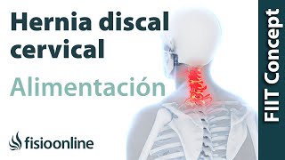 Hernia discal cervical derecha Alimentación nutrición y modificaciones en la dieta [upl. by Anselmo599]