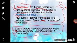 Pathology Neoplasia part1 [upl. by Antons]