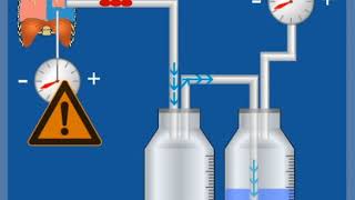 2KammerSystem mit Sog – Funktionsweise  Thoraxdrainage für Einsteiger [upl. by Cad]