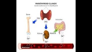 Hiperparatiroidismo [upl. by Abehs]