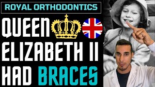 QUEEN ELIZABETH II and her ORTHODONTIC treatment Did you know she had BRACES [upl. by Aelsel4]