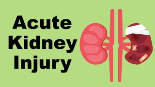 Acute Kidney Injury AKI  causes and management [upl. by Ellitnahc]