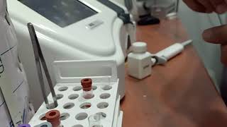 AMYLASE TEST AGD 2020 [upl. by Atenahs931]