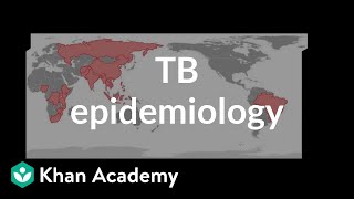 TB epidemiology  Infectious diseases  NCLEXRN  Khan Academy [upl. by Herv433]