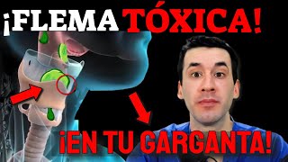 FLEMA TÓXICA en TU GARGANTA ¡ELIMÍNALA INMEDIATAMENTE [upl. by Ial]