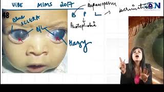 One shot ophthalmology for neet pg  inicetbuphthalmos [upl. by Burman592]