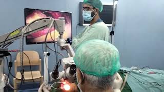 A Complete tympano plasty procedure [upl. by Giavani489]