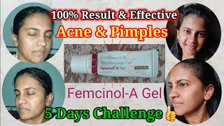 Femcinol A Gel Review Telugu femcinoalAgel pimples acne skincaretips skincare review telugu [upl. by Leanora]