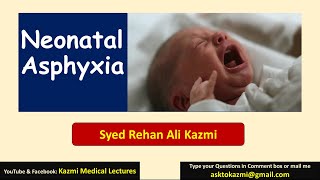 Neonatal Asphyxia  Neonatology  Pediatric Review  KML [upl. by Kaczer]