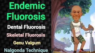 Endemic Fluorosis  Nalgonda Technique  PSM lecture  Community Medicine lecture  Public Health [upl. by Adnuahsor]