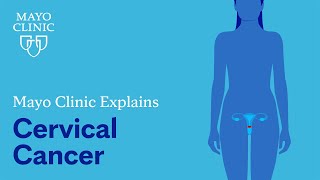 Mayo Clinic Explains Cervical Cancer [upl. by Zoila440]