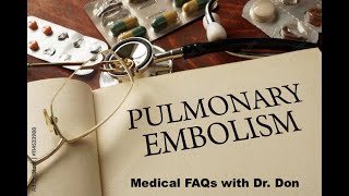 Medical FAQs Pulmonary Embolism Facts and Prevention [upl. by Roach]