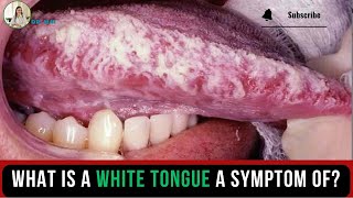 Part 61 What is A White Tongue A Symptom of  DR MAI [upl. by Corder675]