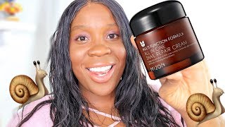 I Tried Snail Cream MIZON All in One Snail Repair Cream Snail Cream For Acne Scars [upl. by Melise]