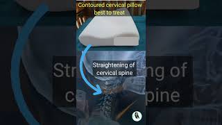 Best pillow to treat straightening of cervical spine  Contoured pillow shorts viralshorts [upl. by Emsoc]