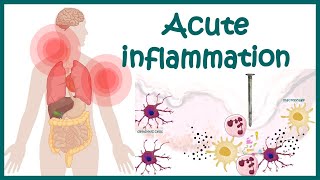 Acute Inflammation  symptoms Pathogenesis Cause of inflammation Mediators of Acute Inflammation [upl. by Holub]