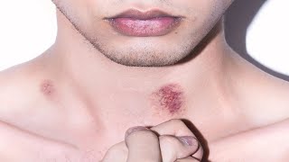 how to give someone a hickey on your neck easy tutorial [upl. by Cioffred613]