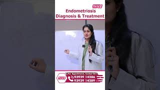 Endometriosis Diagnosis amp Treatment bulkyuterus shorts health healthtips Ferty9 [upl. by Lenahtan810]