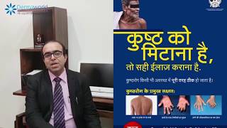 Everything you want to know about Leprosy  कुष्ठ रोग का सही इलाज [upl. by Redmer]