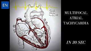 Multifocal Atrial Tachycardia Animation and ECG Shorts [upl. by Elletsirk6]