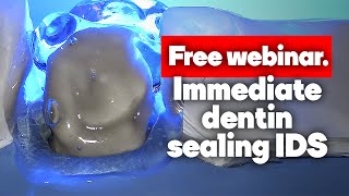 Immediate Dentin Sealing IDS Free webinar [upl. by Arny545]