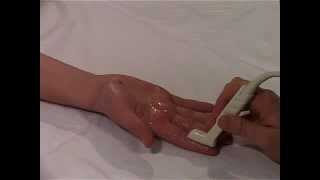 Musculoskeletal Ultrasound Hand 7 palmar longitudinal scan of DIP joint [upl. by Oinigih]