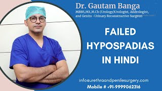 Failed Hypospadias Surgery Information in Hindi  Dr Gautam Banga  failed hypospadias repair [upl. by Inaluiak943]