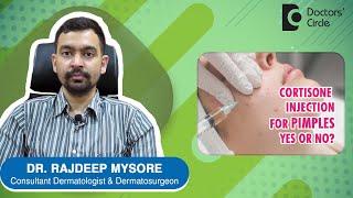 CORTISONE INJECTIONS FOR PIMPLES  Benefits amp Side Effects  Dr Rajdeep Mysore Doctors Circle [upl. by Haeli140]