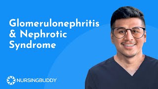 NURSING REVIEW  Glomerulonephritis amp Nephrotic Syndrome [upl. by Rie]