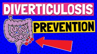 Diverticulosis TREATMENT amp PREVENTION 🍴 Which FOODS to EAT and AVOID [upl. by Ladnek66]